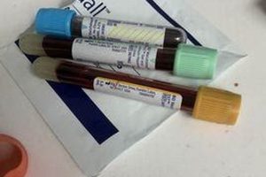 Your Guide to 2579 Chimney Rock Rd, Hendersonville NC | Chimney Works – Expert Chimney Repair, Cleaning & Installation Services