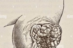 Chimney Sweep's Cancer: A Preventable Hazard Chimney Works – Expert Chimney Repair, Cleaning & Installation Services Chimney Sweep's Cancer: A Preventable Hazard | Chimney Works – Expert Chimney Repair, Cleaning & Installation Services